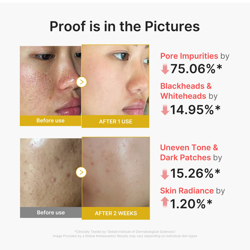 Kojic Acid Turmeric Peel Shot N4
