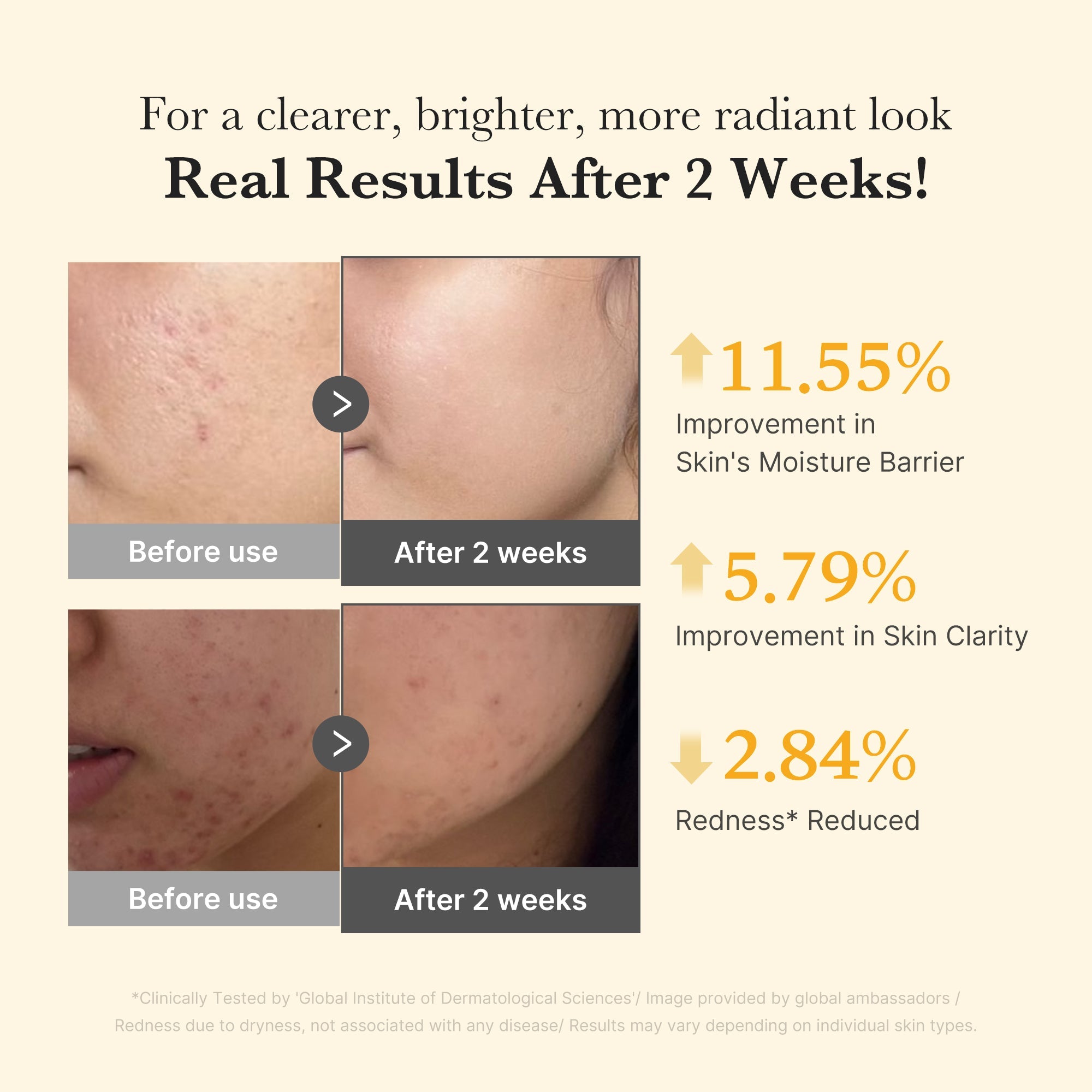 Kojic Acid Turmeric Capsule Serum M9