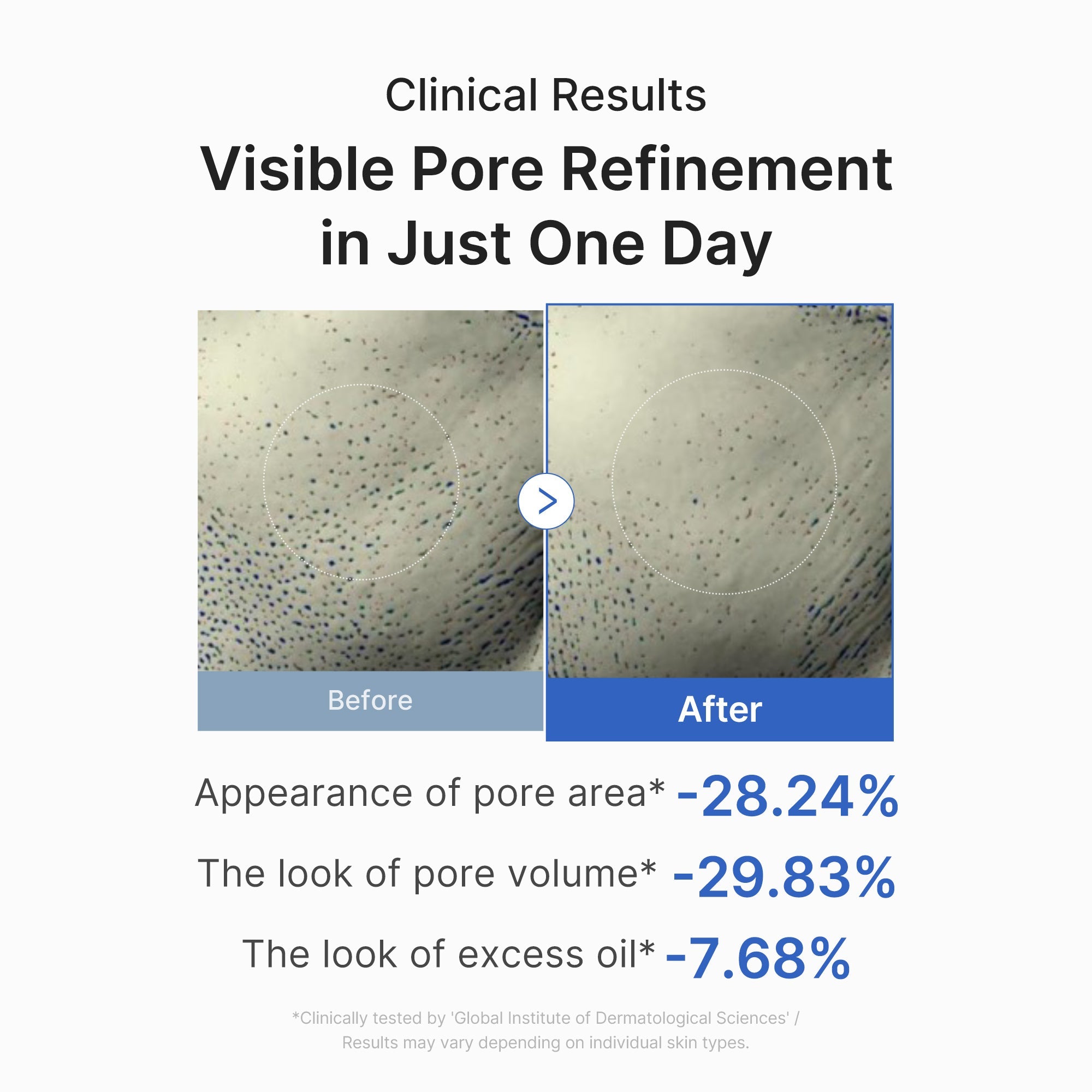 Zero Pore One-day Peptide Serum M3