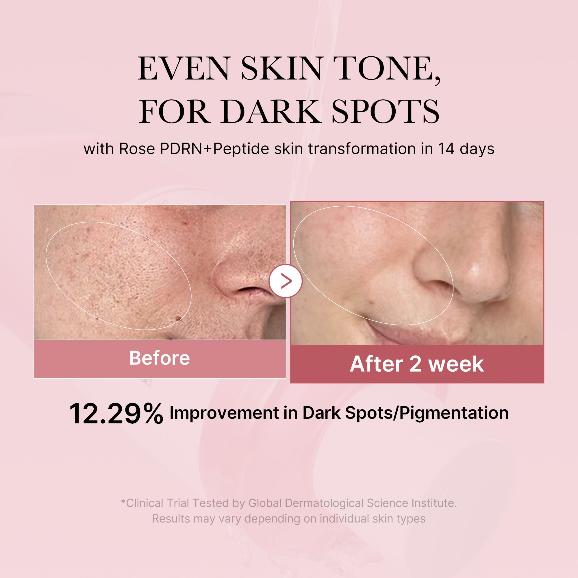 PDRN Pink Peptide Toner D9