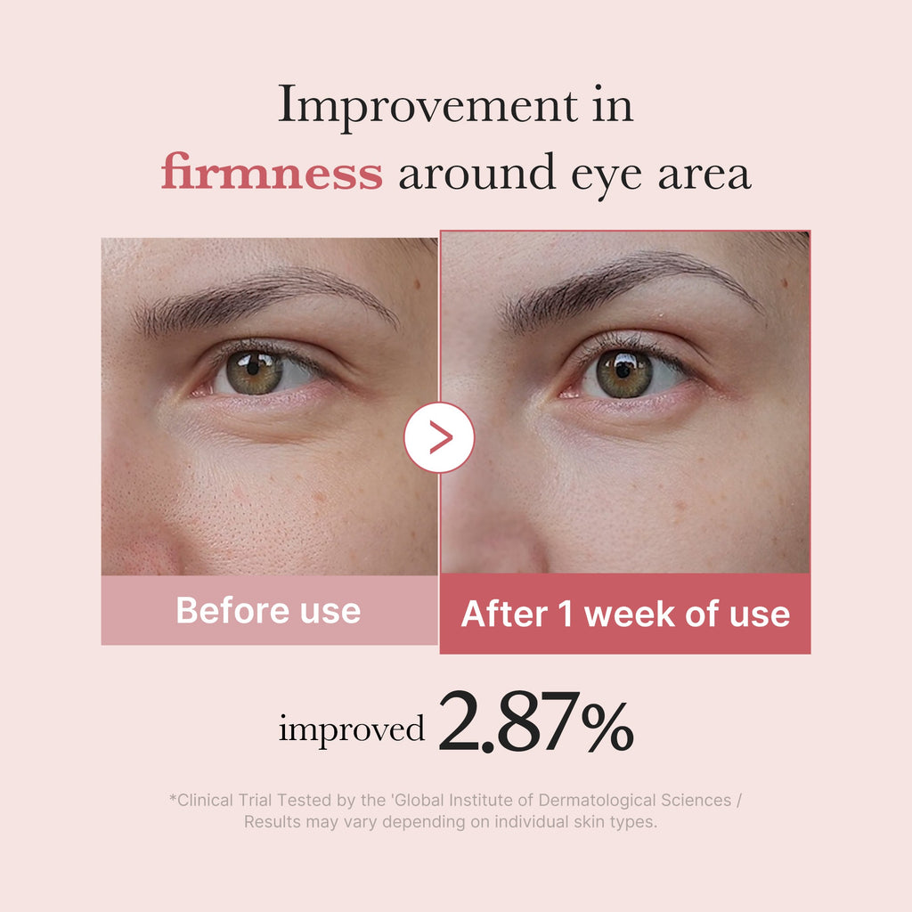 PDRN Pink Peptide Eye Cream H9