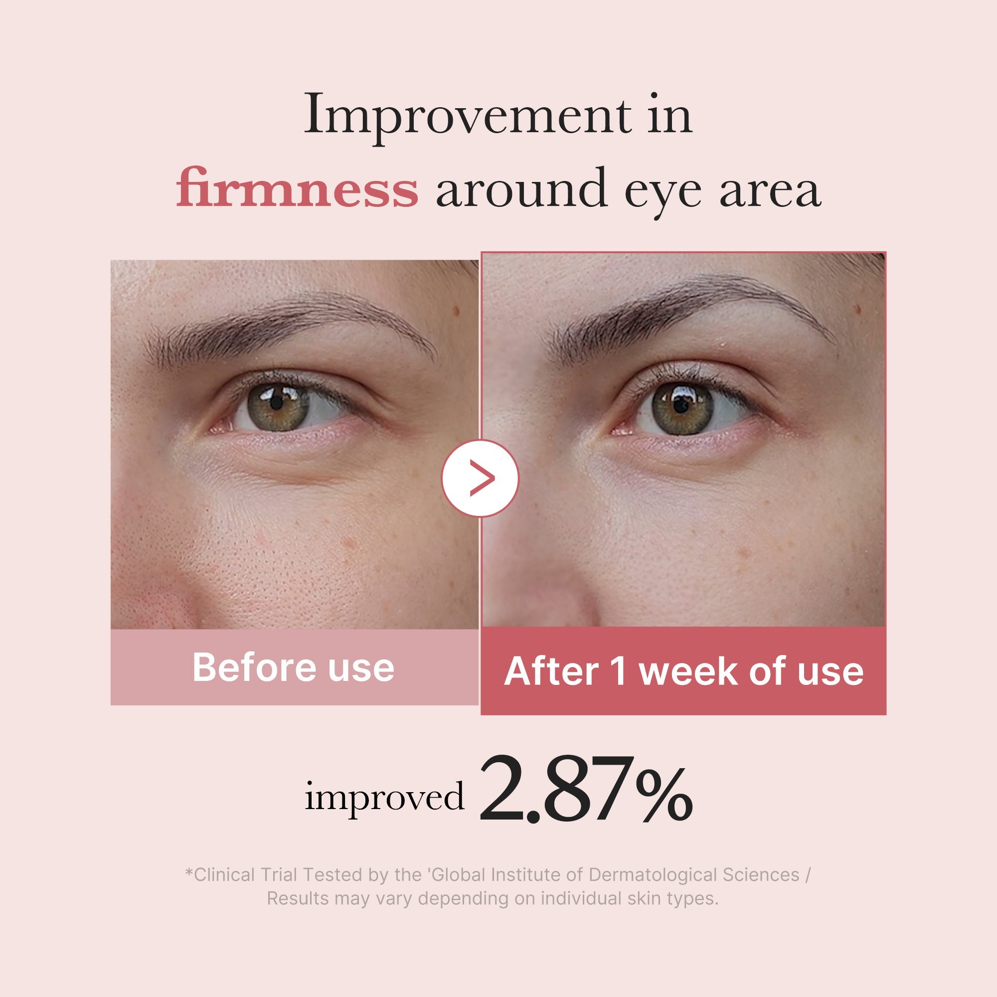 PDRN Pink Peptide Eye Cream H9