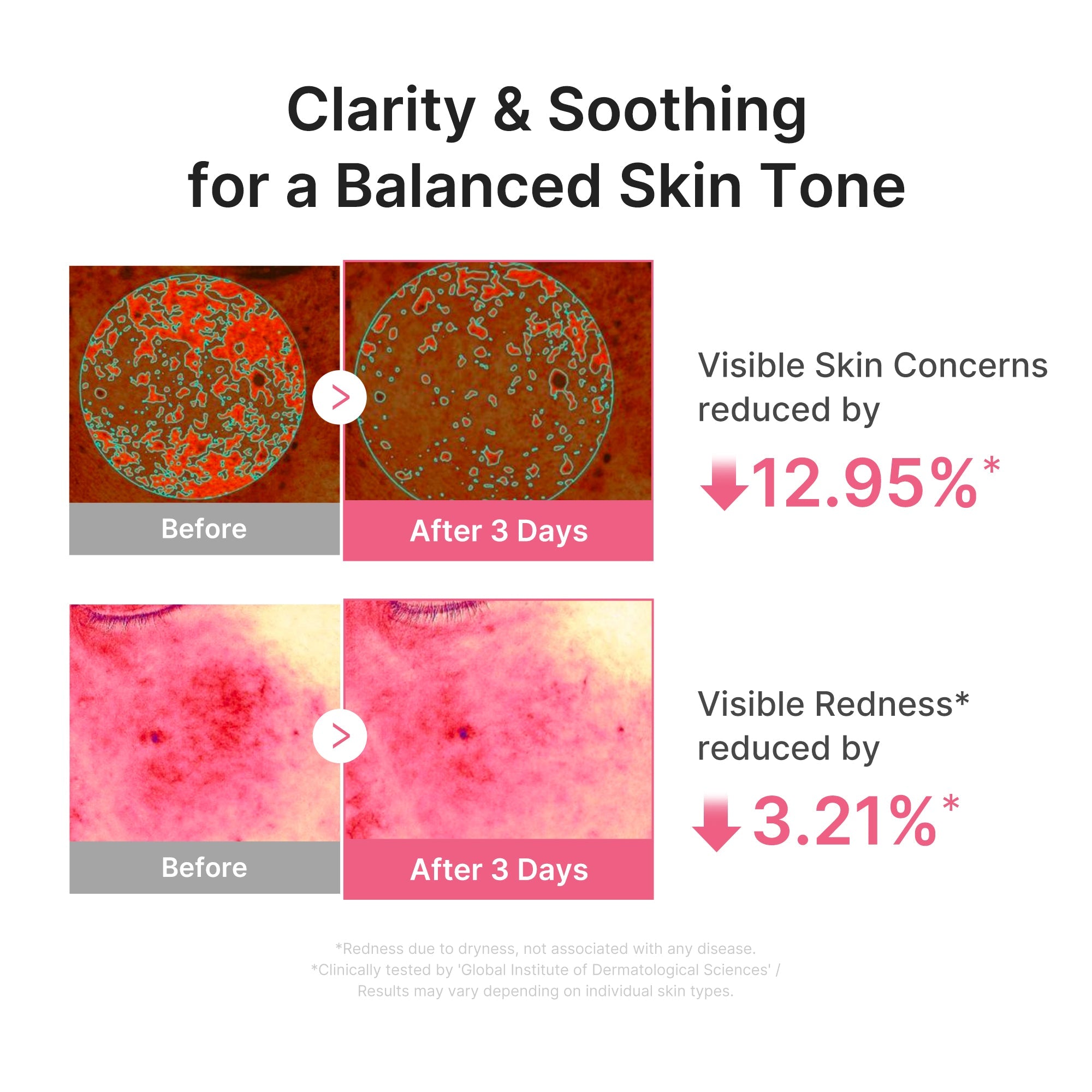 Ultra Light PDRN Pink Peptide Serum H0