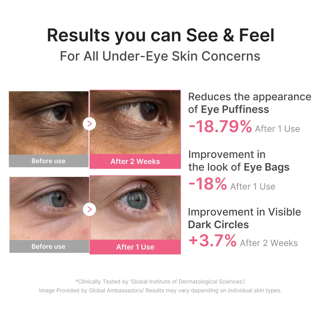 PDRN Caffeine Collagen Eye Patch U6