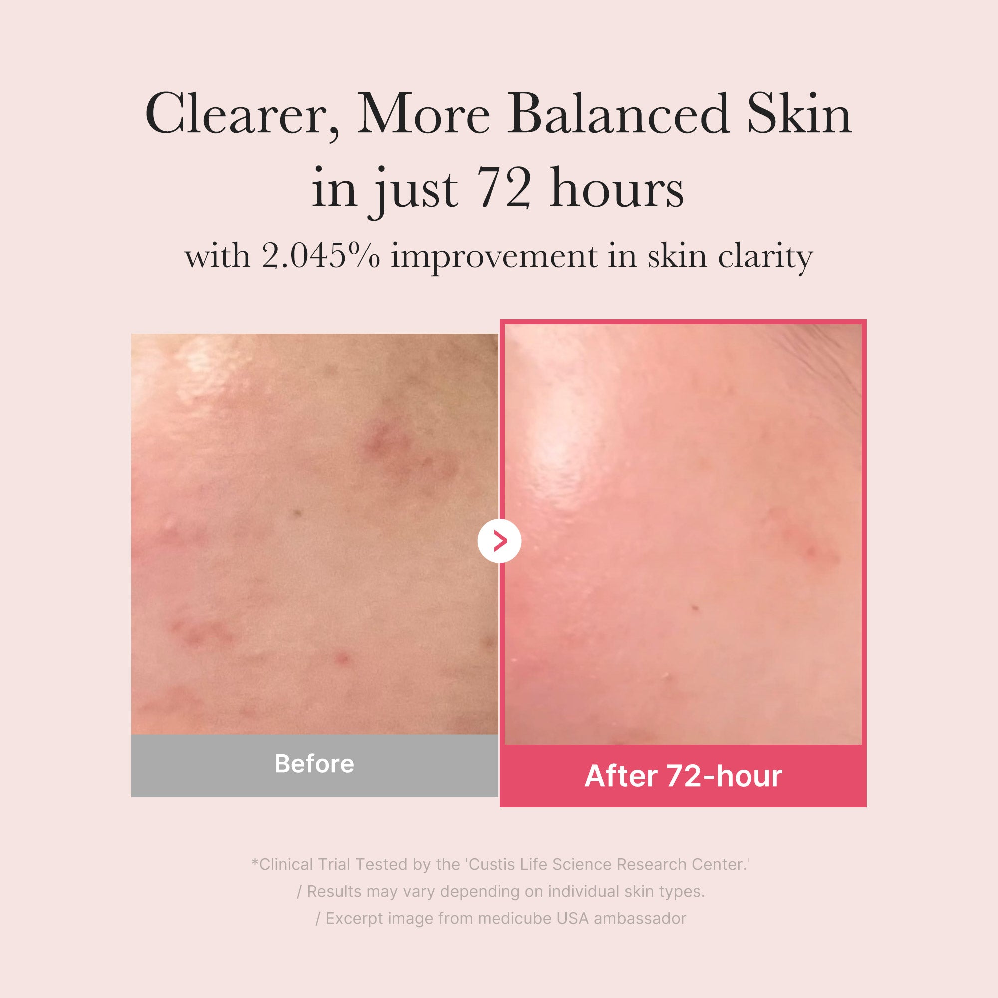 TXA Niacinamide Serum Z3